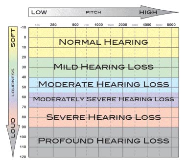 audiogram